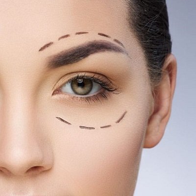 جراحة الجفن في مسقط | علاج الجفن في عمان