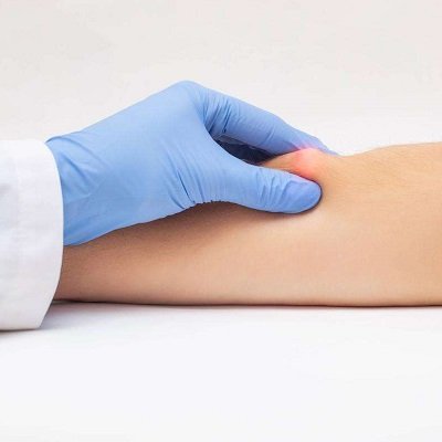 علاج الورم الشحمي في مسقط | إزالة الورم الشحمي في عمان