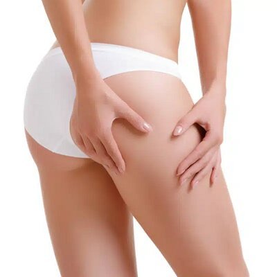 تكبير الأرداف (BBL) | عملية رفع المؤخرة البرازيلية في مسقط