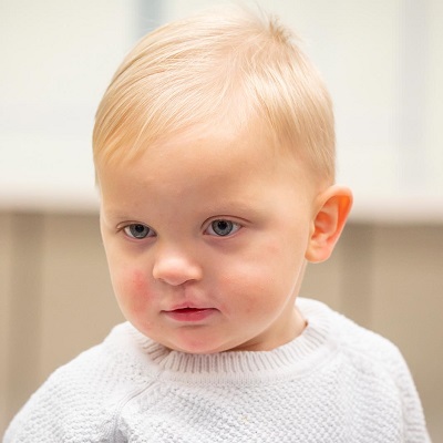 جراحة إصلاح الحنك في مسقط | جراحة الشفة الأرنبية في عمان