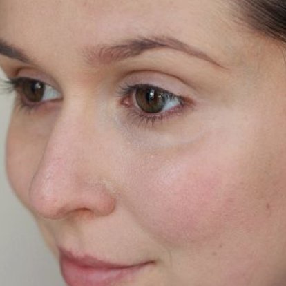 التقشير العضوي التقشير العضوي