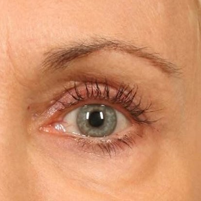 Eyeid Eyeid