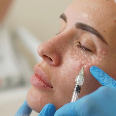 حشو تيوسيال في مسقط حشوات جلدية في عُمان