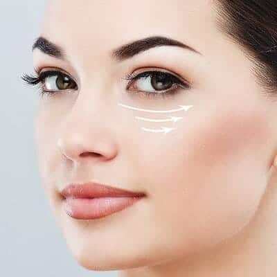 Plexr Plasma Eye Lift in Muscat Blepharoplasty Surgery