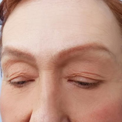 Cosmetic Injectables Cosmetic Injectables