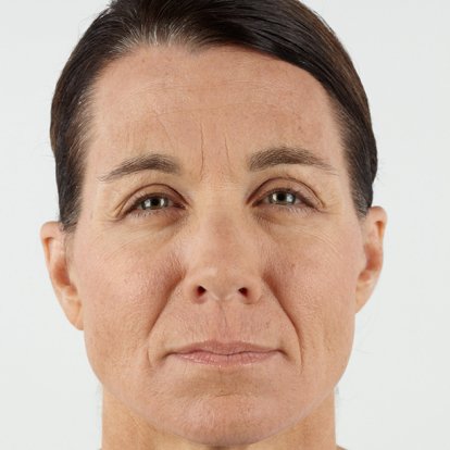 Cosmetic Injectables Cosmetic Injectables