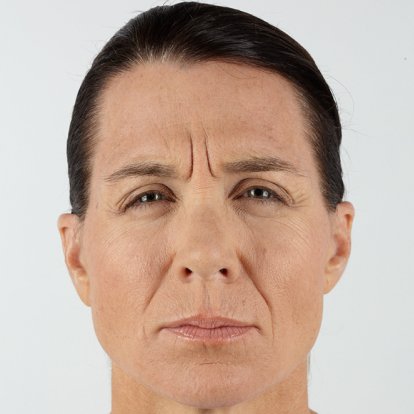 Cosmetic Injectables Cosmetic Injectables