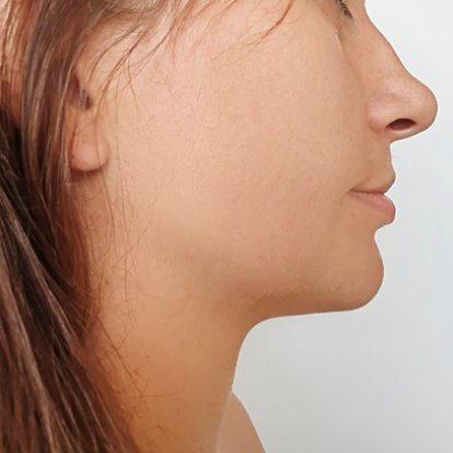 Cosmetic Surgery Cosmetic Surgery