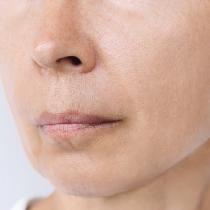 Cosmetic Surgery Cosmetic Surgery