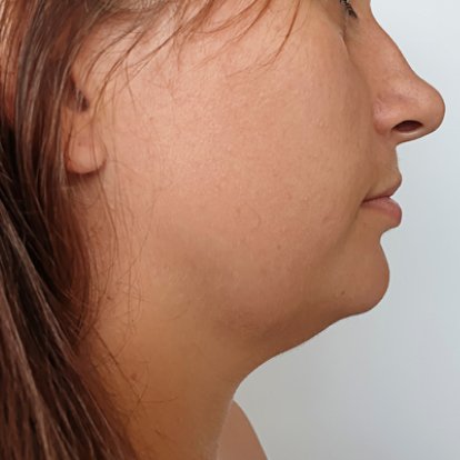Cosmetic Surgery Cosmetic Surgery