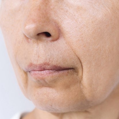 Cosmetic Surgery Cosmetic Surgery