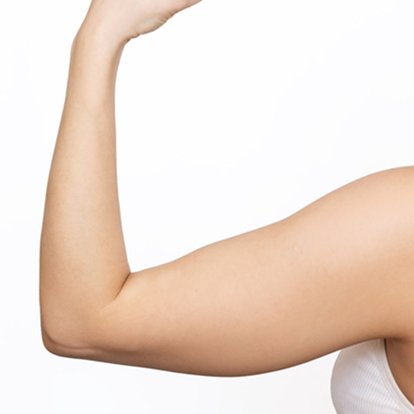 Arm Lift Arm Lift