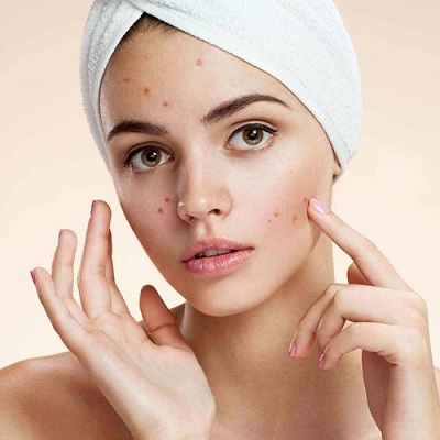 TwAc Treatment in Muscat Skin Rejuvenation Treatment