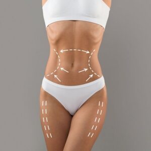 How Long Do Tummy Tuck Results Last?