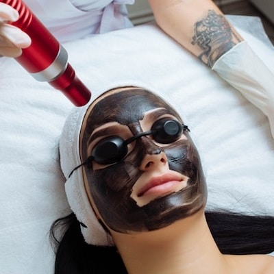 How Often Should You Get Carbon Laser Peel?