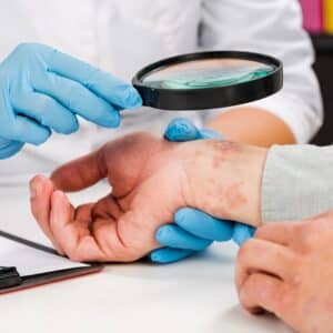 Skin Disorders Treatments By A Dermatologist